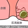 如何战胜肛周脓肿（一