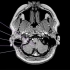 1.颅脑MRI解剖图谱-小脑MRI解剖