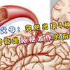 转告父母：突然出现4种表现，可能是脑梗发作的前兆，及时就医