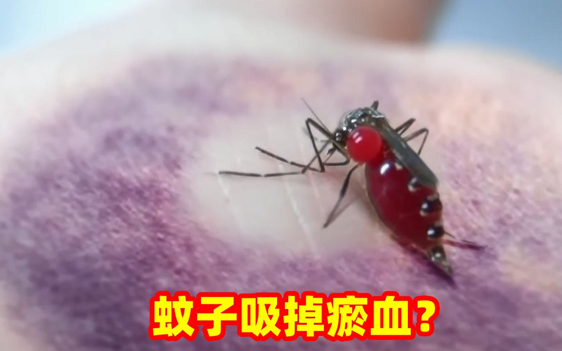 蚊子把瘀血吸干？这是什么操作？蚊子：这血怎么过期啦