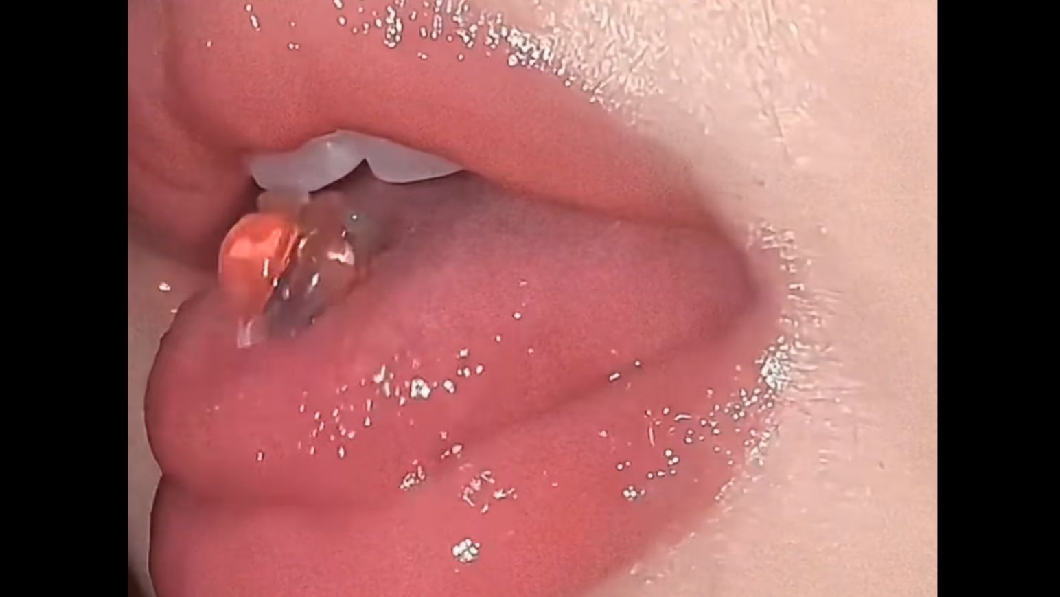 【口腔检测29】一滴都没了吗