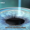 近视激光手术的原理（PRK,LASIK,SMILE
