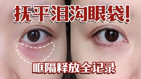 2811c404d9c4425ef32a4cf2ee9dd15c7699b236.jpg@280w_158h_1c_100q.jpg