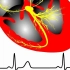 心电图 -- 正常心脏电活动与心电图产生