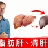 【搬运】Dr.Berg 如何修复肝脏功能