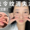 法令纹消失术？这也太厉害了吧