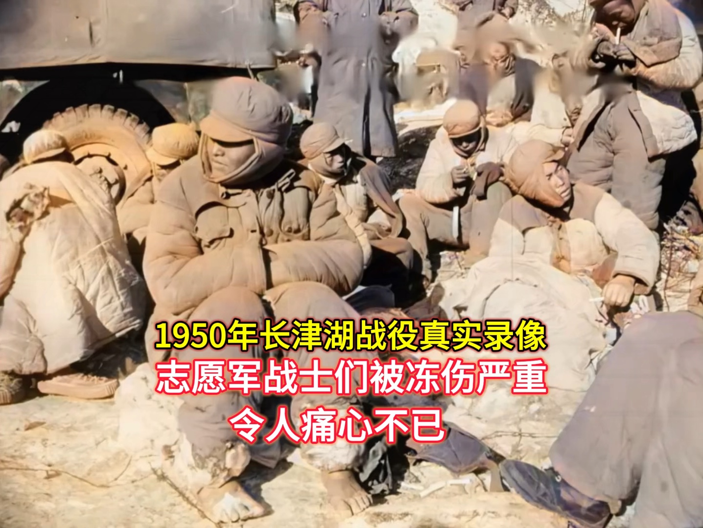 1950年“长津湖战役”志愿军战士们被严重冻伤，令人痛心不已！