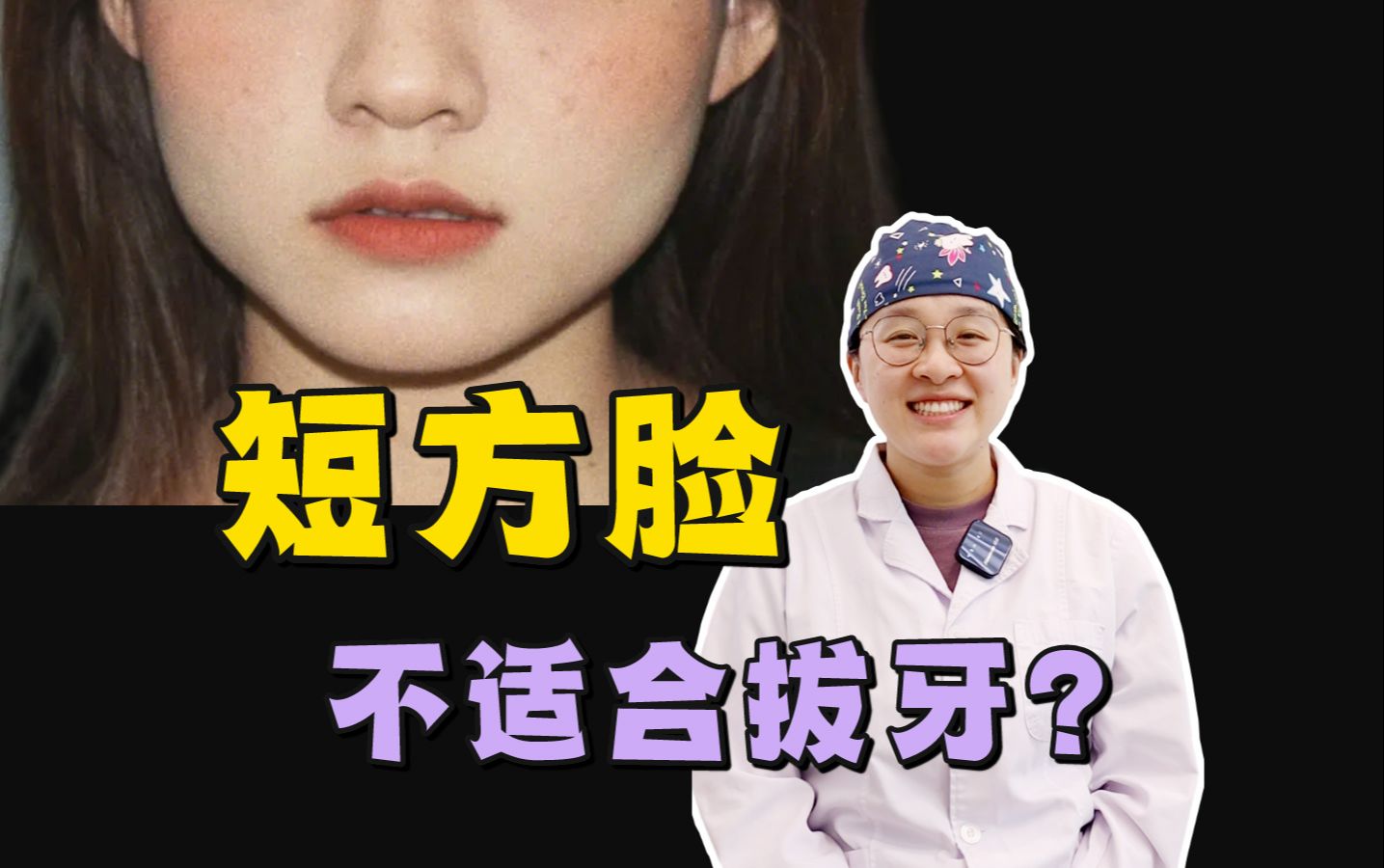 【上海九院】短方脸，为什么不适合拔牙矫正？