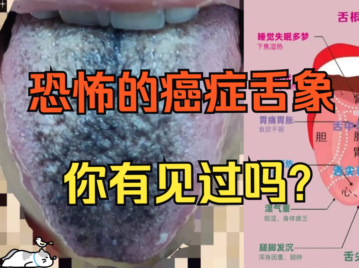 恐怖的癌症舌头，你有见过吗？【胆小慎入】