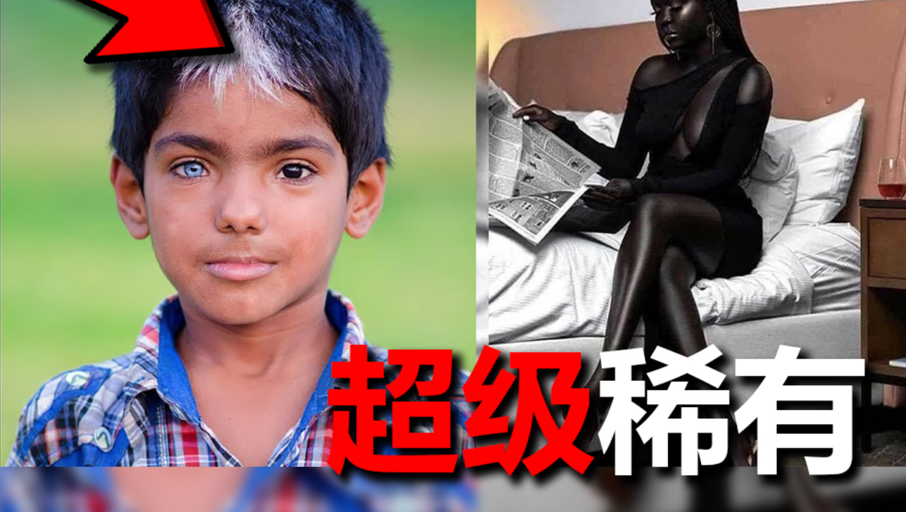 最罕见的人类基因，你有吗？
