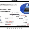 肺结核与肺外结核感染和防控