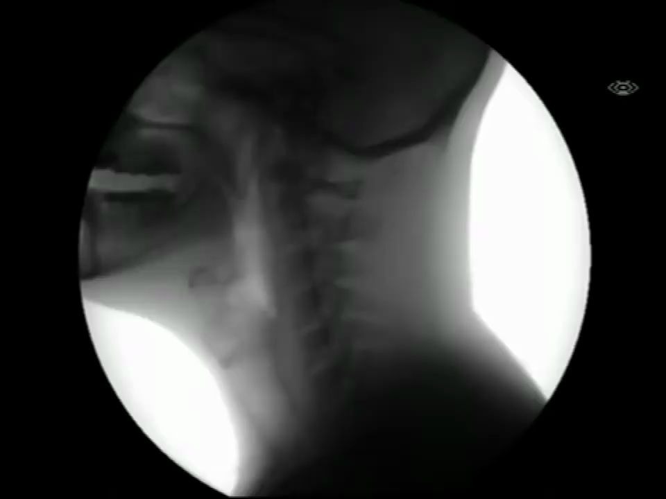 人类吞咽时的X光影像，第一次用这样的视角看身体，感觉好奇妙！
