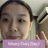 Misery Diary Day