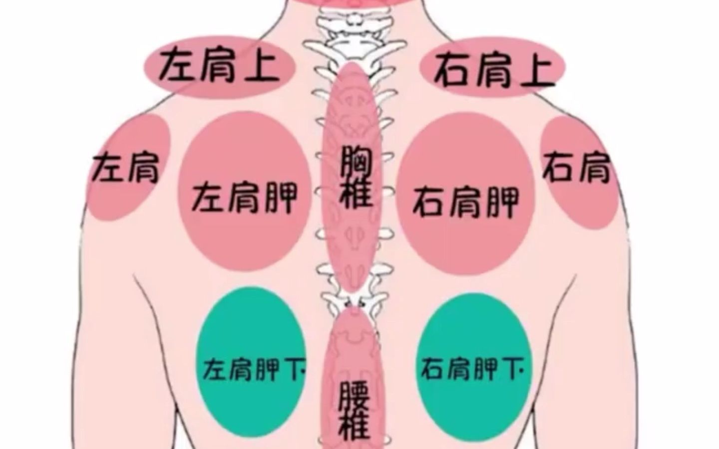 一张图告诉你，后背不同位置疼痛，代表着什么症状