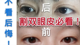 343166a038c5f2dabfb4a9acac7e7e9548cfe595.jpg@280w_158h_1c_100q.jpg