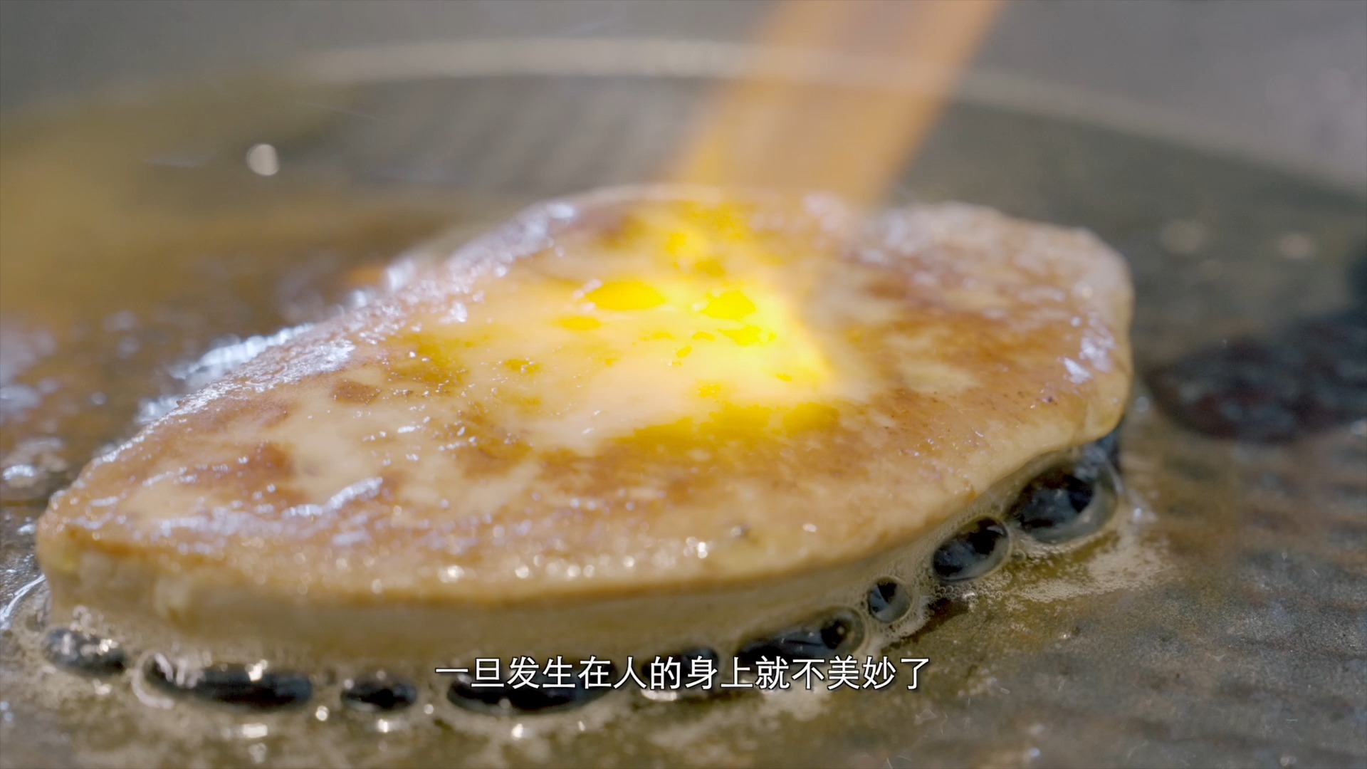 体检查出脂肪肝，该怎么办？