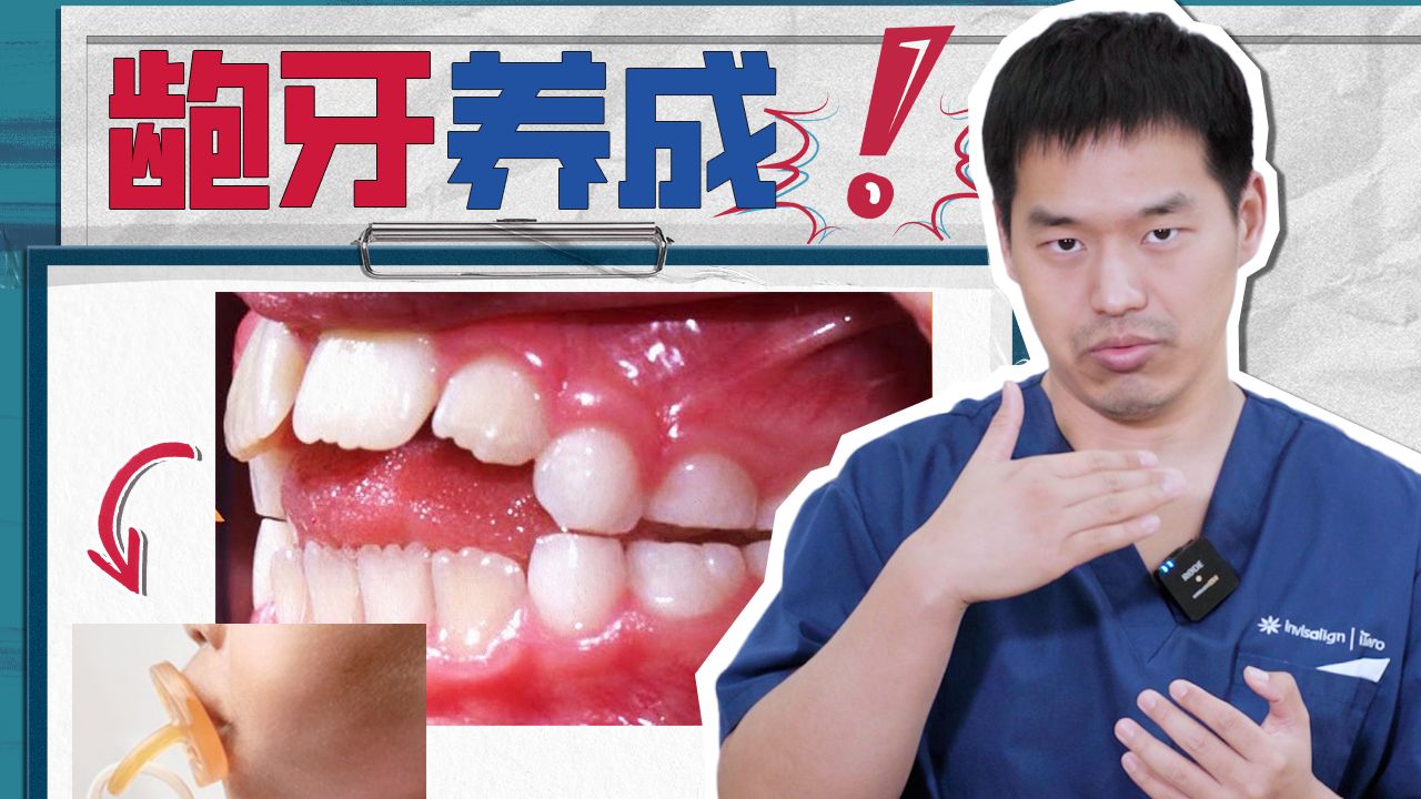 用错安抚奶嘴，带给孩子一口龅牙！