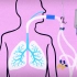 呼吸机是如何工作的？