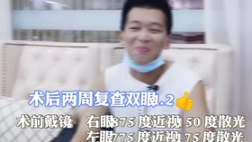 中医治疗近视眼靠谱吗 38588abf8b3e6adc5befb2830737109525673d81.jpg@280w_158h_1c_100q.jpg