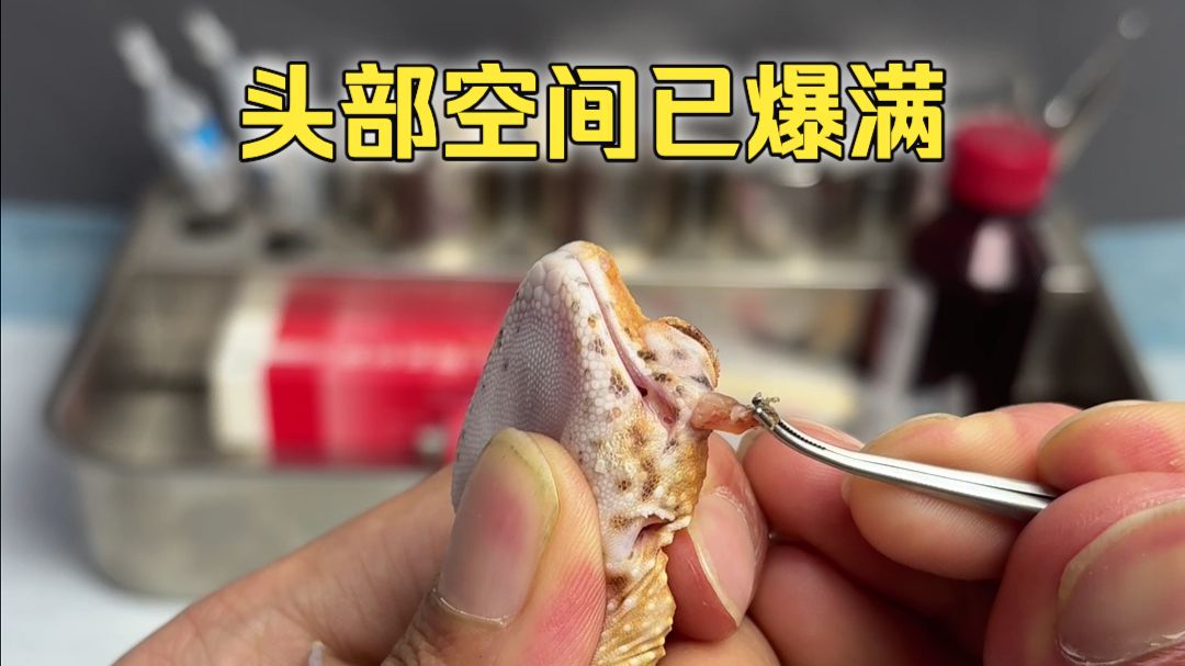 感觉脑袋被掏空，还能康复吗