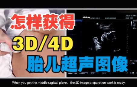 医学超声检查||怎样获得 3D/4D 胎儿图像？