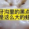 小小黑点，却是大洞