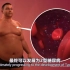 3D医学动画：《肥胖症》