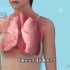 支气管哮喘的发病原因，3D演示。。