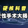 【硬核科普】揭秘变性手术：从男生变成女生需要几步