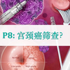 P8：如何筛查宫颈癌，多长时间查一次