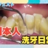 日本小哥第一次洗牙，顺便拔个智齿，补个牙