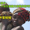 国外可怜的“外星娃娃”出生就被父亲抛弃