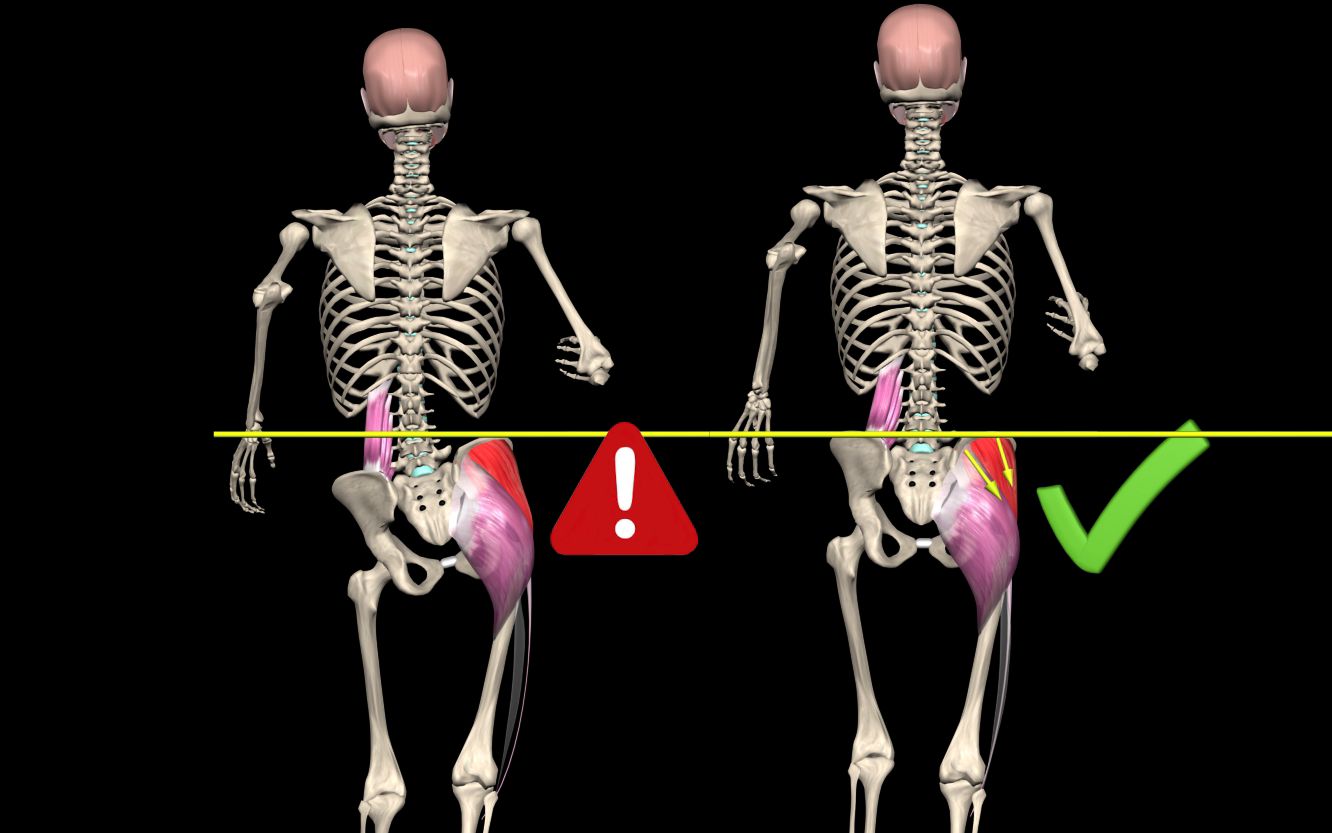 骨盆侧倾、股骨内旋、小腿外翻（矫正） - 知乎