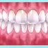 12看牙齿被腐蚀变色的过程，还不放下你的碳酸饮料吗？#大连齿医生口腔