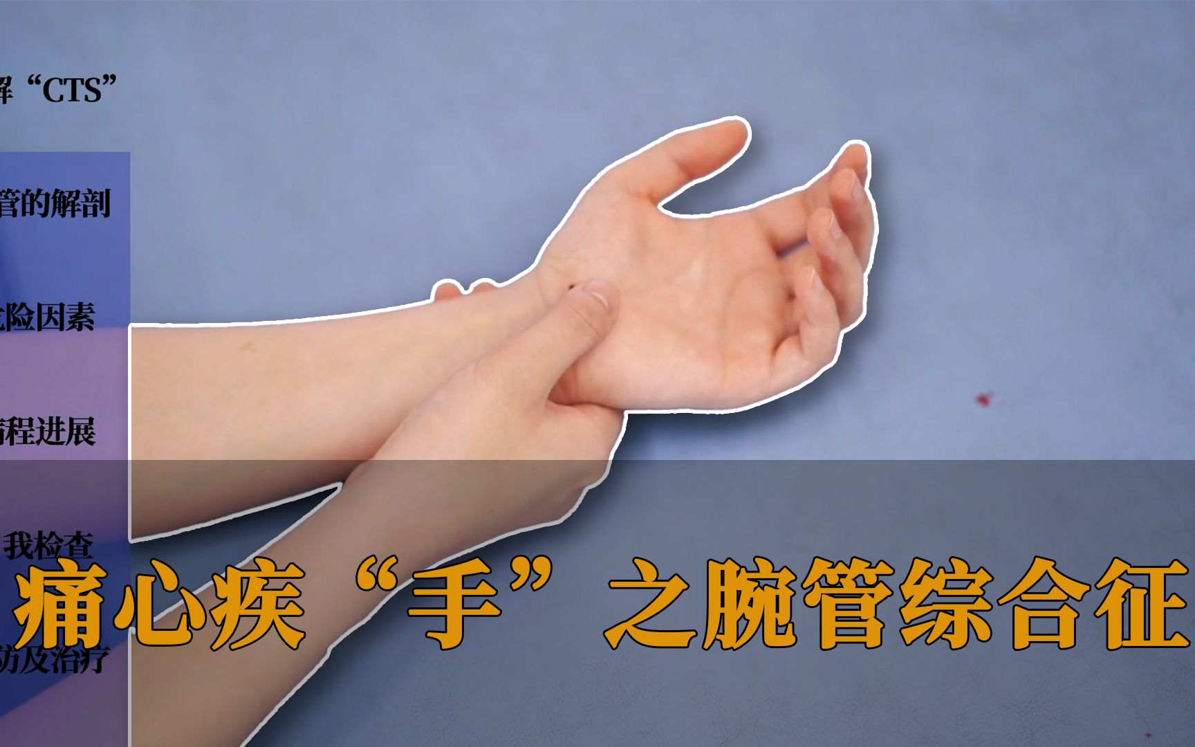 痛心疾“手”之腕管综合征