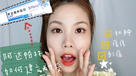 3fba7e6f9c865954e0bacad6a018e49477a61846.jpg@280w_158h_1c_100q.jpg