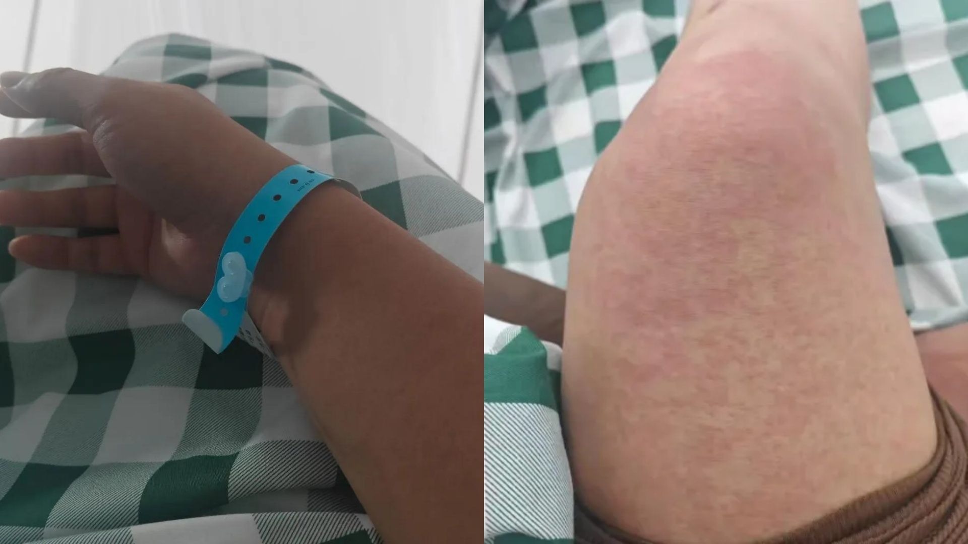 广东佛山累计确诊基孔肯雅热超4000例！患者自述发病过程，疾控中心：这些症状及时就医