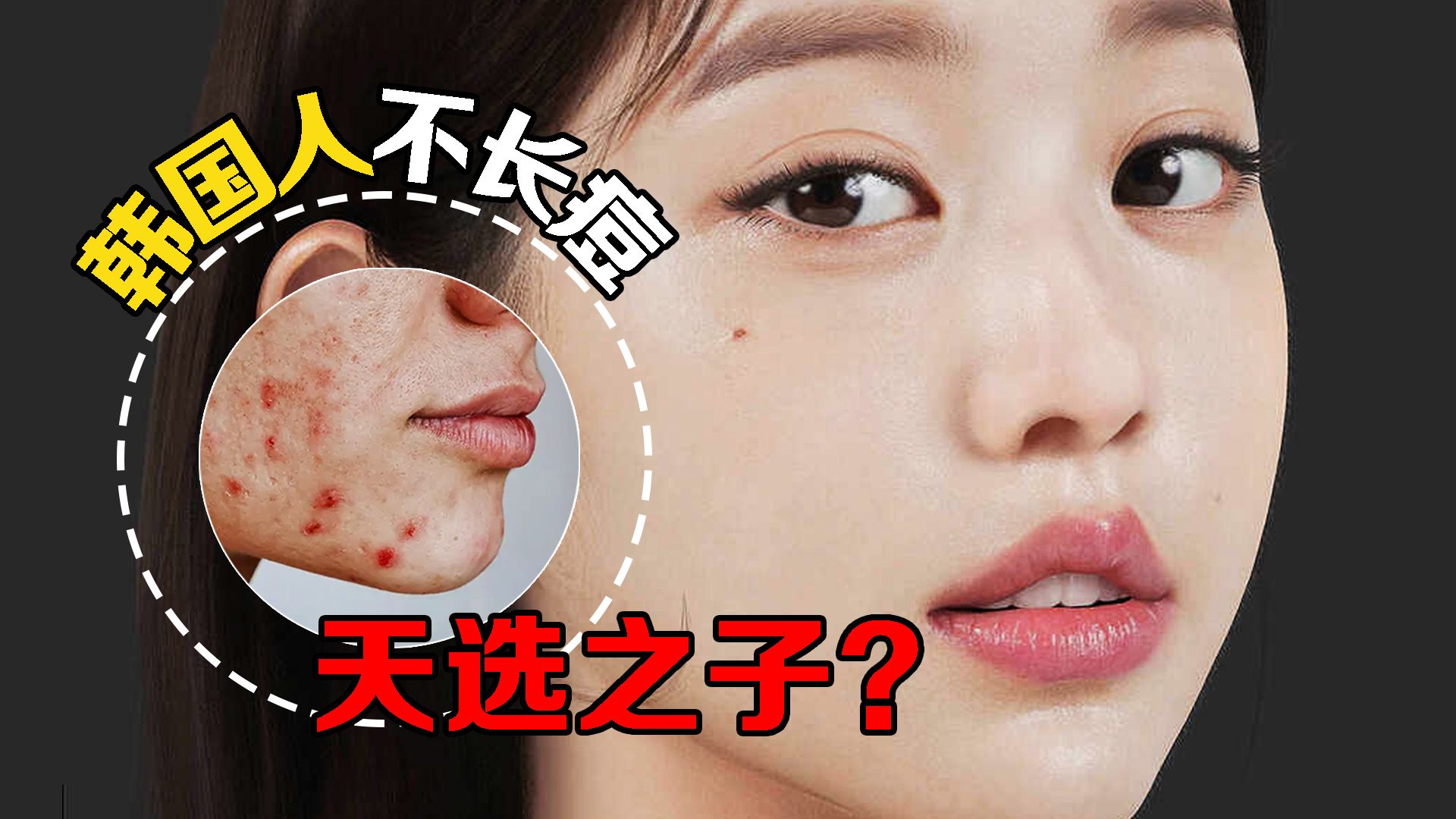 痘痘究竟是如何形成的？为什么韩国人熬夜吃辣，皮肤还那么好？