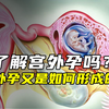 一分钟带你了解宫外孕是如何产生的