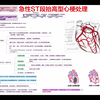 急诊急性冠脉综合征-ST段抬高性心梗处理（参考十版内科学教材