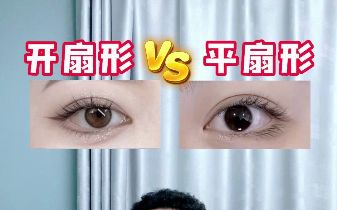 开扇形vs平扇形，关于双眼皮形态究竟该如何选择？
