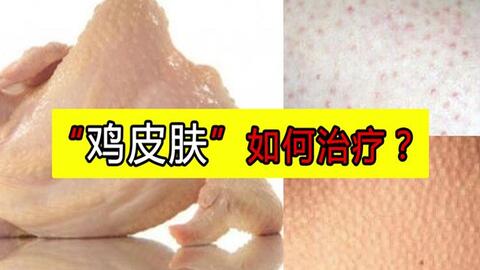 免费领取吃鸡皮肤的应用 49d801f10b3729ac2a7a66e5c940ce336f55349f.jpg@480w_270h_1c