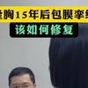 假体隆胸15年后包膜挛缩严重，该如何修复
