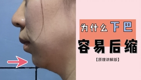 4f1078e7abe3436930de268abd50f8b6815e3e1e.jpg@280w_158h_1c_100q.jpg