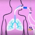 呼吸机的工作原理