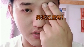 521266dcca7617cea45877616fa5af0a278a80d0.jpg@280w_158h_1c_100q.jpg