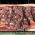 【3D医学动画】烧伤的分类和治疗（中英双字幕+原版英文）