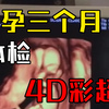 日本老婆怀孕三个月的妇科检查4D彩超视频，好像是男的呢