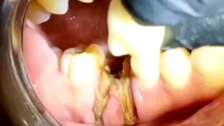 你见过这样的牙齿？