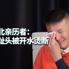 缅北亲历者：惨无人道的折磨手段，脚趾头被开水烫、被刀割、被掰断